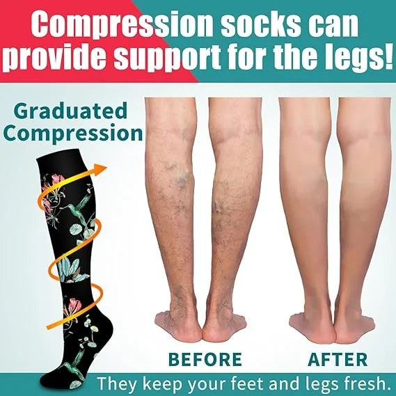 Compression Socks Women for Pregnant Edema Diabetes Varicose Veins Marathon Sports Nurse Socks
