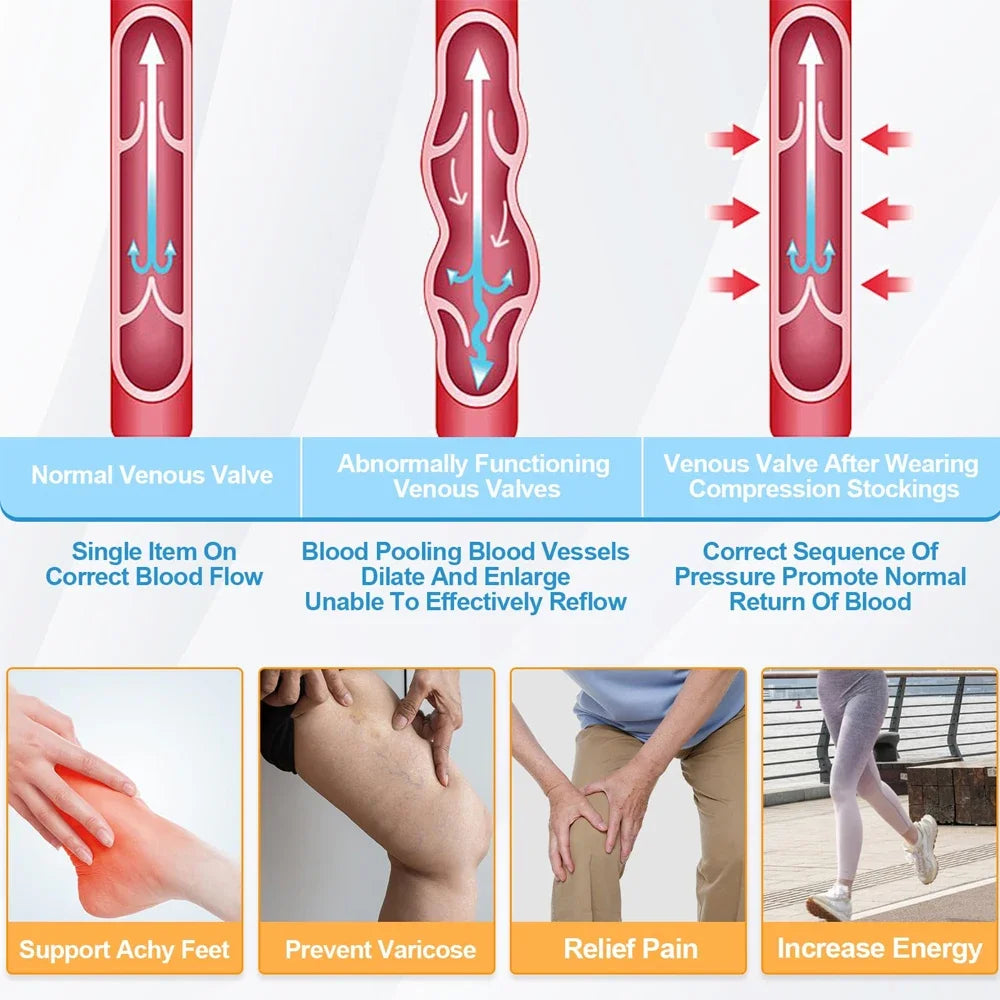 1Pair TED Anti-Embolism Compression Stockings (15-21 mmHg) - Knee-High & Thigh-High Compression Socks for Post-Surgery Recovery