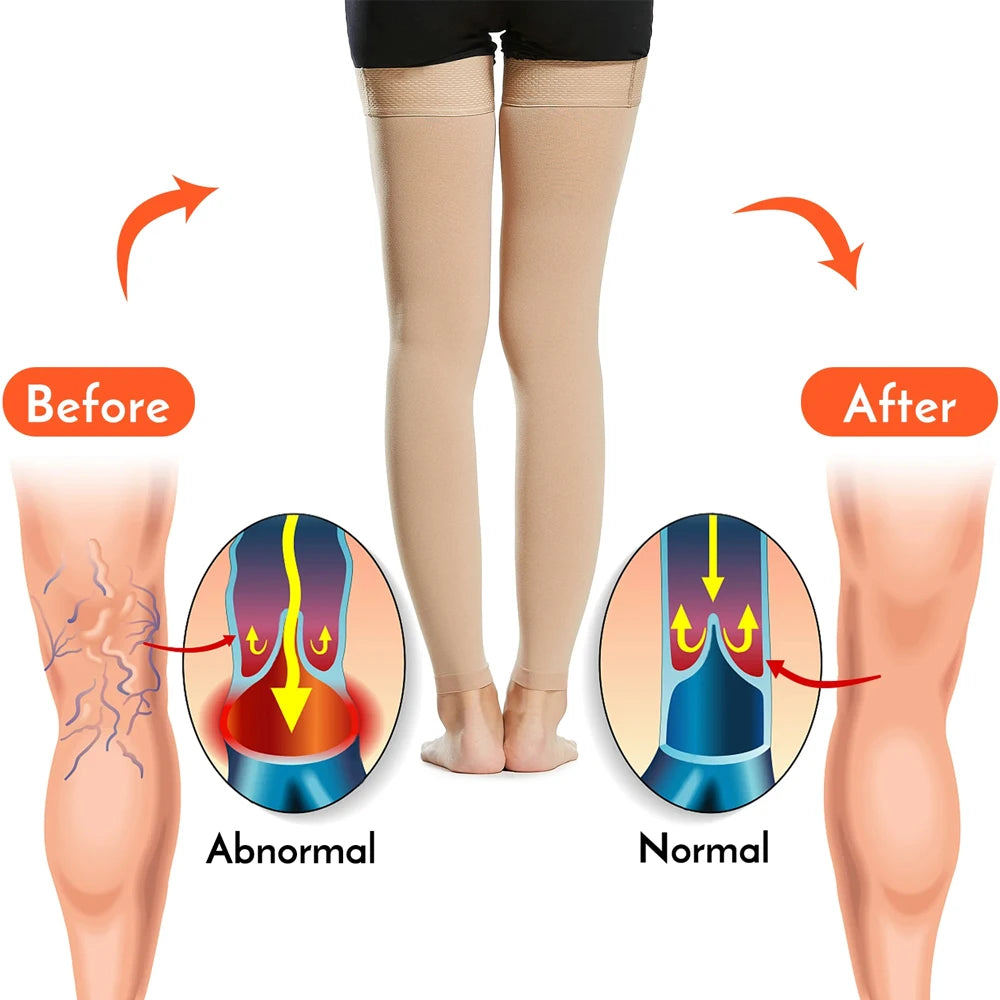 1Pair Thigh High Compression Socks,Firm Support 20-30 mmHg Gradient Compression Stockings with Silicone Band. for Varicose Veins